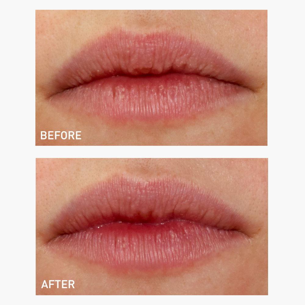 Photo of Plumping Lip Gels